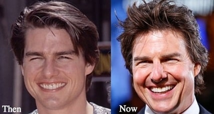 A before and after picture of Tom Cruise's changing face.